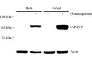 Western blot analysis of PARP1 (ABIN7075114),at dilution of 1: 1000 (PARP1 anticorps  (cleaved))