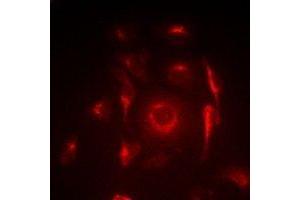 Immunofluorescent analysis of ACAS2 staining in SW620 cells.