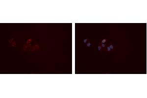 ABIN6277407 staining Hela cells by IF/ICC.