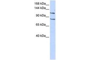 Image no. 1 for anti-CCAAT/enhancer Binding Protein (C/EBP), zeta (CEBPZ) (C-Term) antibody (ABIN6742792) (CEBPZ anticorps  (C-Term))