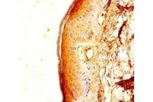 Immunohistochemistry of paraffin-embedded human skin tissue using ABIN7173207 at dilution of 1:100