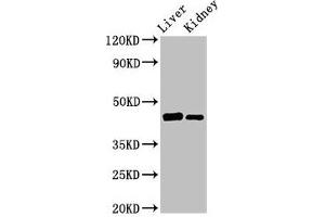 Western Blot Positive WB detected in: Rat liver tissue, Mouse kidney tissue All lanes: GALT antibody at 3 μg/mL Secondary Goat polyclonal to rabbit IgG at 1/50000 dilution Predicted band size: 44, 32 kDa Observed band size: 44 kDa (GALT anticorps  (AA 1-379))