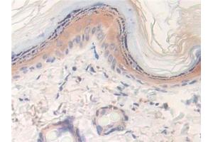 Detection of LXN in Rat Skin Tissue using Polyclonal Antibody to Latexin (LXN)