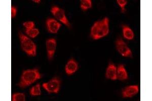 ABIN6278610 staining Hela by IF/ICC. (OR4K2 anticorps  (C-Term))
