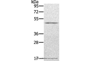Western blot analysis of Human normal stomach tissue, using KDM8 Polyclonal Antibody at dilution of 1:500 (JMJD5 anticorps)