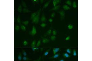 Immunofluorescence analysis of HeLa cells using ARRB1 Polyclonal Antibody (beta Arrestin 1 anticorps)