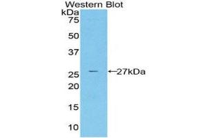 Western Blotting (WB) image for anti-Cysteine-Rich, Angiogenic Inducer, 61 (CYR61) (AA 178-381) antibody (ABIN1858600) (CYR61 anticorps  (AA 178-381))