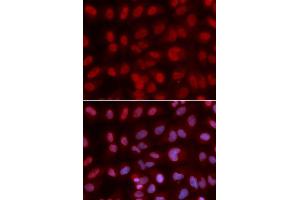 Immunofluorescence analysis of U2OS cells using SIN3A antibody.