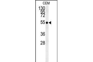 ZIC3 Antibody (Center) (ABIN650719 and ABIN2839389) western blot analysis in CEM cell line lysates (35 μg/lane). (ZIC3 anticorps  (AA 239-267))