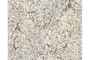 IHC analysis of Filamin A/FLNA using anti-Filamin A/FLNA antibody (ABIN7601783). (Filamin A anticorps  (AA 451-638))