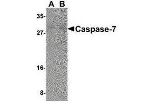Western Blotting (WB) image for anti-Caspase 7, Apoptosis-Related Cysteine Peptidase (CASP7) (N-Term) antibody (ABIN2477919) (Caspase 7 anticorps  (N-Term))
