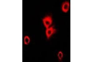 Immunofluorescent analysis of Alpha-tubulin 4a staining in Hela cells.