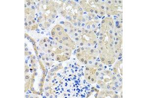 Immunohistochemistry of paraffin-embedded mouse kidney using BSND antibody. (BSND anticorps  (AA 54-320))