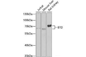 Western blot analysis of extracts of various cell lines using BTD Polyclonal Antibody at dilution of 1:1000. (BTD anticorps)