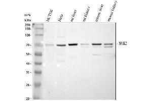 Western blot analysis of SPHK2 using anti-SPHK2 antibody (ABIN5692941).