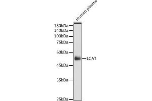Western blot analysis of extracts of Human plasma, using LCAT antibody (ABIN6130520, ABIN6143108, ABIN6143110 and ABIN6215439) at 1:1000 dilution. (LCAT anticorps  (AA 25-440))