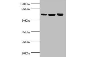 Western blot All lanes: CTNNBL1 antibody at 5. (CTNNBL1 anticorps  (AA 264-563))