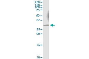Immunoprecipitation of KHK transfected lysate using anti-KHK MaxPab rabbit polyclonal antibody and Protein A Magnetic Bead , and immunoblotted with KHK MaxPab mouse polyclonal antibody (B01) .