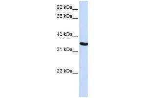 WB Suggested Anti-DPPA2 Antibody Titration: 0. (DPPA2 anticorps  (N-Term))