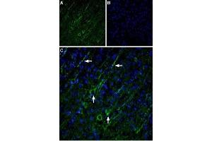 Expression of TRPC5 in rat cortex - Immunohistochemical staining of rat cortex using Anti-TRPC5 Antibody (ABIN7043823, ABIN7043974 and ABIN7043975).