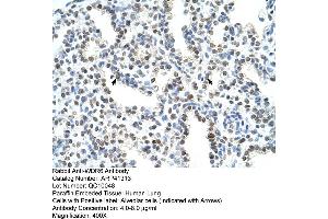Rabbit Anti-WDR6 Antibody  Paraffin Embedded Tissue: Human Lung Cellular Data: Alveolar cells Antibody Concentration: 4. (WDR6 anticorps  (C-Term))