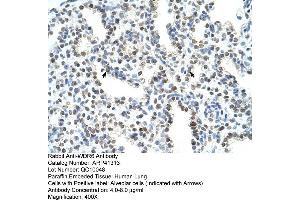 Rabbit Anti-WDR6 Antibody  Paraffin Embedded Tissue: Human Lung Cellular Data: Alveolar cells Antibody Concentration: 4. (WDR6 anticorps  (C-Term))