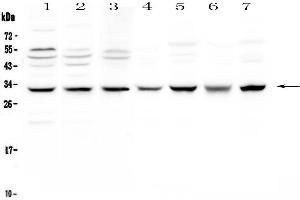 Western blot analysis of SDHB using anti-SDHB antibody .