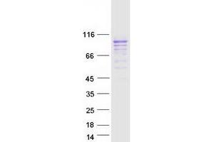 Validation with Western Blot