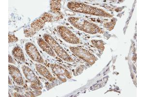 IHC-P Image Immunohistochemical analysis of paraffin-embedded human colon, using VAM1, antibody at 1:100 dilution. (MPP6 anticorps  (N-Term))