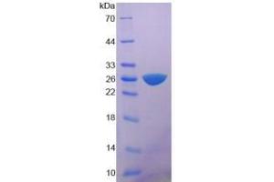 SDS-PAGE analysis of Rat MYH6 Protein.
