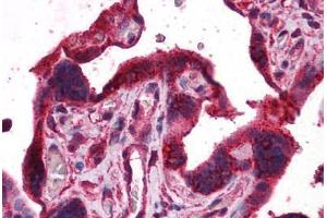 Human Placenta: Formalin-Fixed, Paraffin-Embedded (FFPE) (DPP8 anticorps  (AA 1-39))