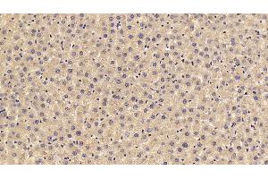 Detection of C3a in Rat Liver Tissue using Polyclonal Antibody to Complement Component 3a (C3a)