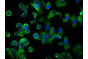 Immunofluorescence staining of MCF-7 cells with ABIN7158571 at 1:200, counter-stained with DAPI. (LRP2 anticorps  (AA 202-332))