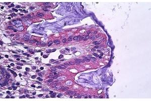 Human Colon, Epithelium: Formalin-Fixed, Paraffin-Embedded (FFPE) (SLC12A2 anticorps  (AA 769-783))