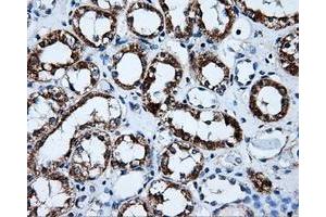 Immunohistochemical staining of paraffin-embedded liver tissue using anti-HSD17B10mouse monoclonal antibody. (HSD17B10 anticorps)