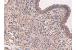 IHC-P analysis of Mouse Uterus Tissue, with DAB staining. (FAP anticorps  (AA 542-761))