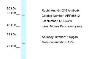 Western Blotting (WB) image for anti-Predicted Gene 216 (GM216) (Middle Region) antibody (ABIN2786243) (GM216 anticorps  (Middle Region))