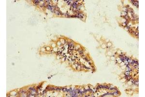 Immunohistochemistry of paraffin-embedded human small intestine tissue using ABIN7172867 at dilution of 1:100