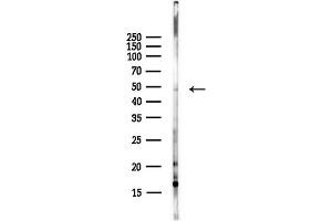 anti-Proteasome (Prosome, Macropain) 26S Subunit, ATPase, 3 (PSMC3) (Internal Region) antibody