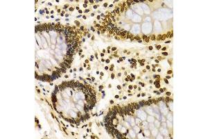 Immunohistochemistry of paraffin-embedded Human colon using Lamin A/C antibody.