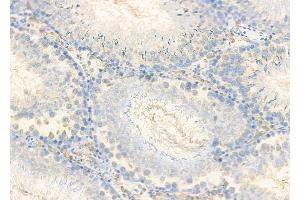 ABIN6261363 and ABIN6278853 at 1/100 staining Rat testis tissue by IHC-P. (CALY anticorps  (Internal Region))