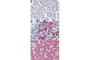 Immunohistochemistry (Formalin/PFA-fixed paraffin-embedded sections) of human heart (A), human spleen (B) and human liver tissue (C) tissue with CYSLTR2 polyclonal antibody . (CasLTR2 anticorps  (N-Term))