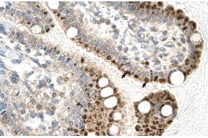 Human Intestine; Rabbit Anti-ZFP1 Antibody. (Zfp-1 anticorps  (N-Term))