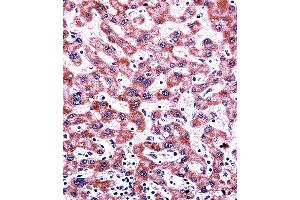 CYP2C9 Antibody (N-term) ((ABIN392355 and ABIN2841994))immunohistochemistry analysis in formalin fixed and paraffin embedded human liver tissue followed by peroxidase conjugation of the secondary antibody and DAB staining.