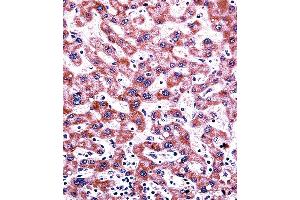 CYP2C9 Antibody (N-term) ((ABIN392355 and ABIN2841994))immunohistochemistry analysis in formalin fixed and paraffin embedded human liver tissue followed by peroxidase conjugation of the secondary antibody and DAB staining.