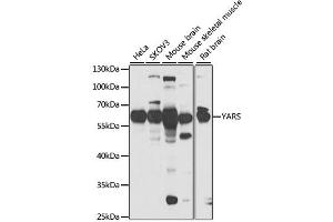 Western blot analysis of extracts of various cell lines, using YARS antibody. (YARS anticorps)
