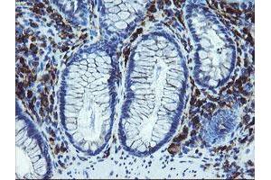 Immunohistochemical staining of paraffin-embedded Human colon tissue using anti-LRRC25 mouse monoclonal antibody. (LRRC25 anticorps)