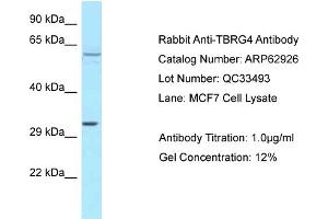 Western Blotting (WB) image for anti-Transforming Growth Factor beta Regulator 4 (TBRG4) (C-Term) antibody (ABIN2789300)