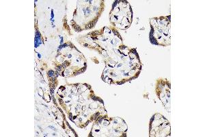 Immunohistochemistry of paraffin-embedded human placenta using LIN28B Rabbit mAb (ABIN7268267) at dilution of 1:100 (40x lens). (LIN28B anticorps)