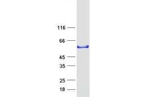 Validation with Western Blot